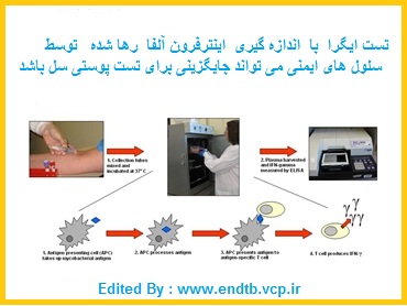 تست های ایگرا برای تشخیص سل