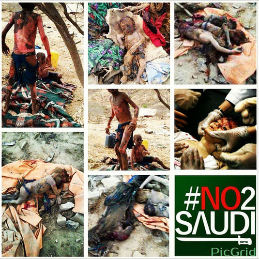 یمن.جنگ یمن.حملات جدید به یمن.کودکان بی خانمان یمن.عکس.عکس کودکان آسیب دیده یمن.عکس +18.حملات عربستان به یمن.عکس +18 یمن.تصاویر دردناک از بمباران یمن