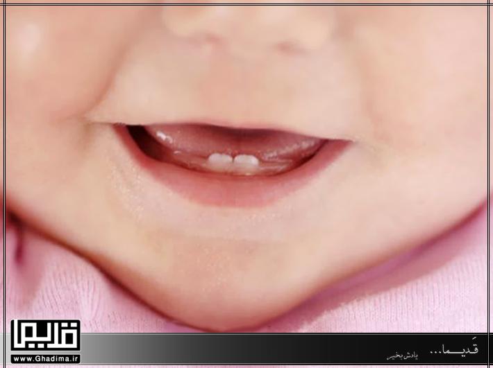 دندان های شیری کودک
