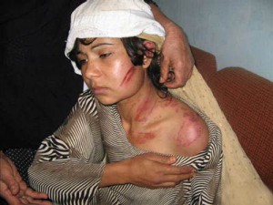 افغانستان بدترین کشور دنیا برای زنان