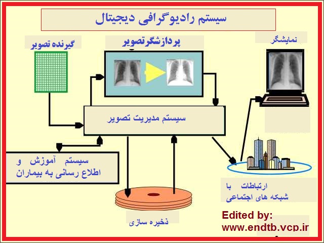 رادیوگرافی دیجیتال