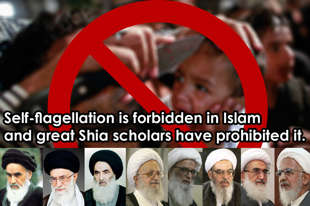 Ashura self-flagellation is forbidden in Islam