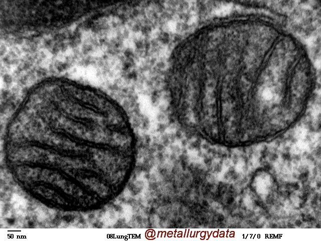 http://s6.picofile.com/file/8255749342/Mitochondria_mammalian_lung_TEM.jpg