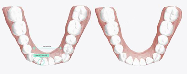 اصلاح سه ویژگی مهم دندان برای زیباتر کردن لبخند