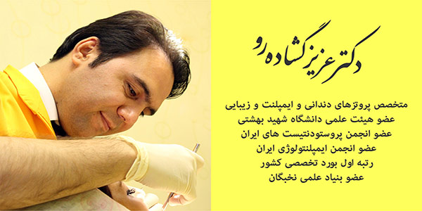 متخصص ایمپلنت دندان خوب در تهران