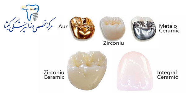 انواع کامپوزیت های در دسترس برای کارهای زیبایی دندان