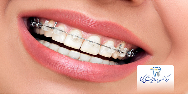 اولويت بندی درمان دندانپزشكي در بيماران ارتودنسي توسط متخصص ارتودنسی