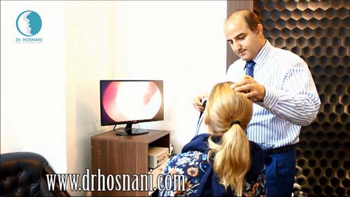 عمل بینی - سی تی اسکن - معاینه بینی